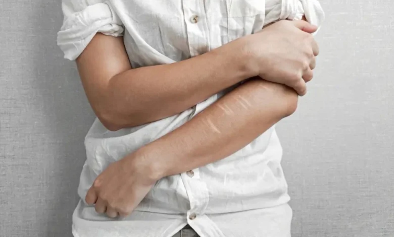 خودآزاری چیست و چه زمانی به متخصص سلامت روان مراجعه کنیم؟
